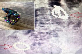 Screenshot_20250720_180632_Facebook