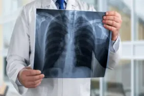 Sifa-Tip-Hastanesi-Pendik-Radyoloji-ve-MR-Hizmetleri-–-Hizli-ve-Guvenli-Goruntuleme-3